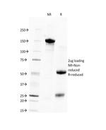 Human Nuclear Antigen (HNA) (Human Cell Marker) Antibody in SDS-PAGE (SDS-PAGE)