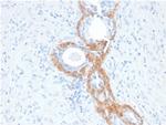 Cytokeratin, Basic (Type II or HMW) Recombinant Mouse Monoclonal Antibody (rKRTH, 2148)