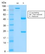 Cytokeratin, Basic (Type II or HMW) Antibody in SDS-PAGE (SDS-PAGE)