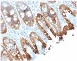 Cytokeratin 8/18 Monoclonal Antibody (rKRT8.18/1346)