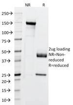 Cytokeratin 5/6/18 Antibody in SDS-PAGE (SDS-PAGE)