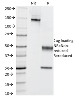 Cytokeratin 5/6 (Basal, Myoepithelial & Mesothelial Cell Marker) Antibody in SDS-PAGE (SDS-PAGE)