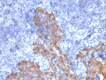 Cytokeratin 5/6 (Basal, Myoepithelial & Mesothelial Cell Marker) Antibody in Immunohistochemistry (Paraffin) (IHC (P))