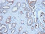 Cytokeratin, pan (Epithelial Marker) Antibody in Immunohistochemistry (Paraffin) (IHC (P))
