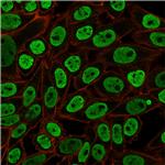 Nuclear Antigen Monoclonal Antibody (NM106)