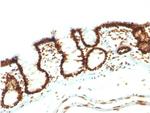 Nuclear Antigen Antibody in Immunohistochemistry (Paraffin) (IHC (P))