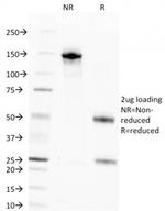 Nuclear Antigen Antibody in SDS-PAGE (SDS-PAGE)