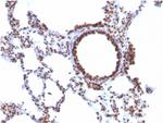 Nuclear Antigen Antibody in Immunohistochemistry (Paraffin) (IHC (P))