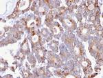 Thomsen-Friedenreich Antigen/CD176 (Pan Carcinoma Marker) Monoclonal Antibody (A84-A/F10)