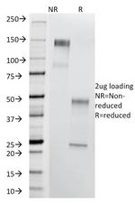 Thomsen-Friedenreich Antigen/CD176 (Pan Carcinoma Marker) Antibody in SDS-PAGE (SDS-PAGE)