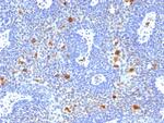 HPV-16 (Human Papilloma Virus 16) Monoclonal Antibody (HPV16/1296)