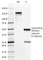 HPV-16 (Human Papilloma Virus 16) Antibody in SDS-PAGE (SDS-PAGE)