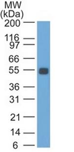 Ep-CAM/CD326 (Rat) Antibody in Western Blot (WB)