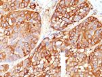 Melanoma Marker (MART-1 + Tyrosinase + gp100) Monoclonal Antibody (DT101, BC199, T311, HMB45)