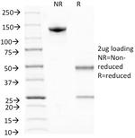 Bromodeoxyuridine (BrdU) (Proliferation Marker) Antibody in SDS-PAGE (SDS-PAGE)