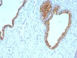 Cytokeratin 5/6 (Basal, Myoepithelial and Mesothelial Cell Marker) Monoclonal Antibody (KRT5.6/9104)