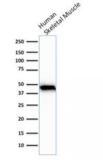 Actin, Muscle Specific (Muscle Cell Marker) Monoclonal Antibody (rMSA/953)