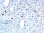 Cytomegalovirus p65 (CMV-p65) Recombinant Mouse Monoclonal Antibody (rCMV/9827)