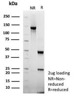Cytomegalovirus p65 (CMV-p65) Antibody in SDS-PAGE (SDS-PAGE)