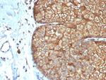 Cytokeratin, Type I (Epithelial Marker) Monoclonal Antibody (rKRTL/6616)