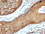 Cytokeratin, Type I (Epithelial Marker) Antibody in Immunohistochemistry (Paraffin) (IHC (P))