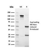 Cytokeratin, Type I (Epithelial Marker) Antibody in SDS-PAGE (SDS-PAGE)