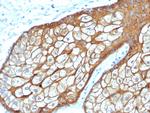 Cytokeratin, Type II (Epithelial Marker) Monoclonal Antibody (rKRTH/6617)