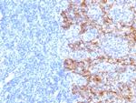 Cytokeratin, Acidic (Type I or LMW) (Epithelial Marker) Monoclonal Antibody (SPM115)
