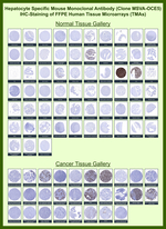 Hepatocyte Specific Antigen (Hepatocellular Marker) Monoclonal Antibody (MSVA-OCE5)