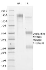 HSV1 (Herpes Simplex Virus Type I) Antibody in SDS-PAGE (SDS-PAGE)