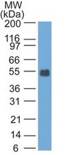 Ep-CAM/CD326 (Rat) Antibody in Western Blot (WB)