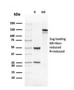 Double Stranded DNA (dsDNA) Antibody in SDS-PAGE (SDS-PAGE)