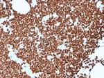 Double Stranded DNA (dsDNA) Antibody in Immunohistochemistry (Paraffin) (IHC (P))