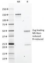 Bromodeoxyuridine (BrdU) (Proliferation Marker) Antibody in SDS-PAGE (SDS-PAGE)