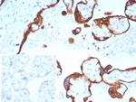 Cytokeratin, Acidic (Type I or LMW) (Epithelial Marker) Recombinant Mouse Monoclonal Antibody (rKRTL/8751)
