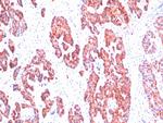 Cytokeratin, Basic (Type II or HMW) (Epithelial Marker) Monoclonal Antibody (SPM116)