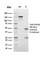 Nuclear Antigen (Pan-NuclearMarker) Antibody in SDS-PAGE (SDS-PAGE)