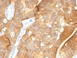 Cytokeratin 8/18 Monoclonal Antibody (K8.8, DC10)