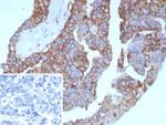 Pan-HLA-II (DP, DQ, DR) Recombinant Mouse Monoclonal Antibody (rHLA-Pan/8847)