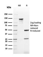 HPV-16 (Human Papilloma Virus 16) Antibody in SDS-PAGE (SDS-PAGE)