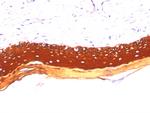 Cytokeratin, Acidic (Type I or LMW) Antibody in Immunohistochemistry (Paraffin) (IHC (P))
