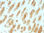 Cytokeratin, Acidic (Type I or LMW) Monoclonal Antibody (KRTL, 1077)