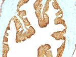 Cytokeratin, Acidic (Type I or LMW) Antibody in Immunohistochemistry (Paraffin) (IHC (P))