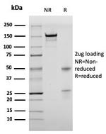 Bromodeoxyuridine (BrdU) (Proliferation Marker) Antibody in SDS-PAGE (SDS-PAGE)