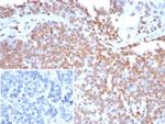 Double Stranded DNA (dsDNA) (Nuclear Marker) Antibody in Immunohistochemistry (Paraffin) (IHC (P))