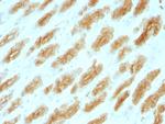 Cytokeratin, Basic (Type II or HMW) Monoclonal Antibody (KRTH, 1076)