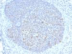 HPV16 E1/E4 (Human Papilloma Virus 16) Monoclonal Antibody (HPV16 E1/E4)