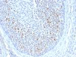 HPV16 E1/E4 (Human Papilloma Virus 16) Monoclonal Antibody (HPV16 E1/E4)