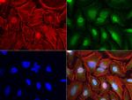 MSMB Antibody in Immunocytochemistry (ICC/IF)