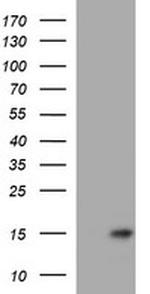 MSMB Antibody in Western Blot (WB)